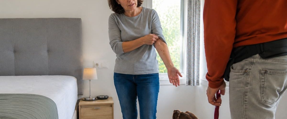 Mujer enseñando picaduras en el brazo durante una inspección canina de chinches en casa